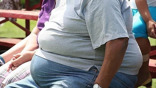 En este momento estás viendo La obesidad, factor de riesgo infravalorado en el cáncer de colon